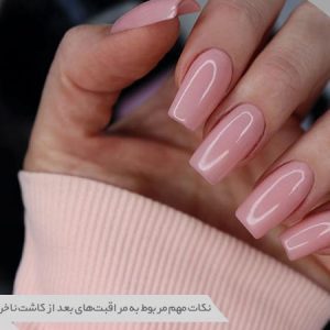 ناخن بعد کاشت