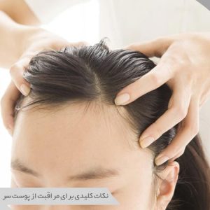 مراقبت از پوست سر