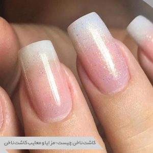 کاشت ناخن